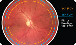 Powerful Optics Volk
