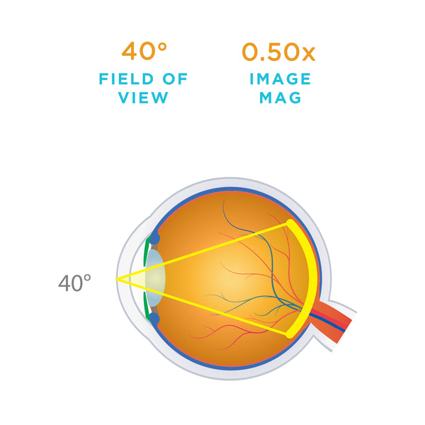 40 degree field of view lens