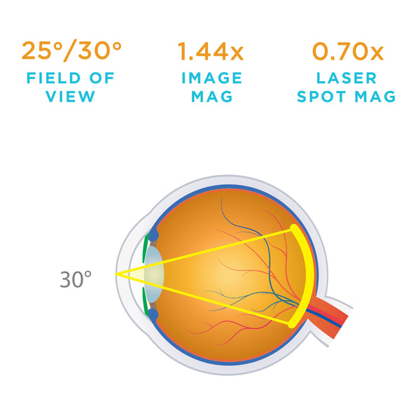 35° Field of View Fundus Lase Lens