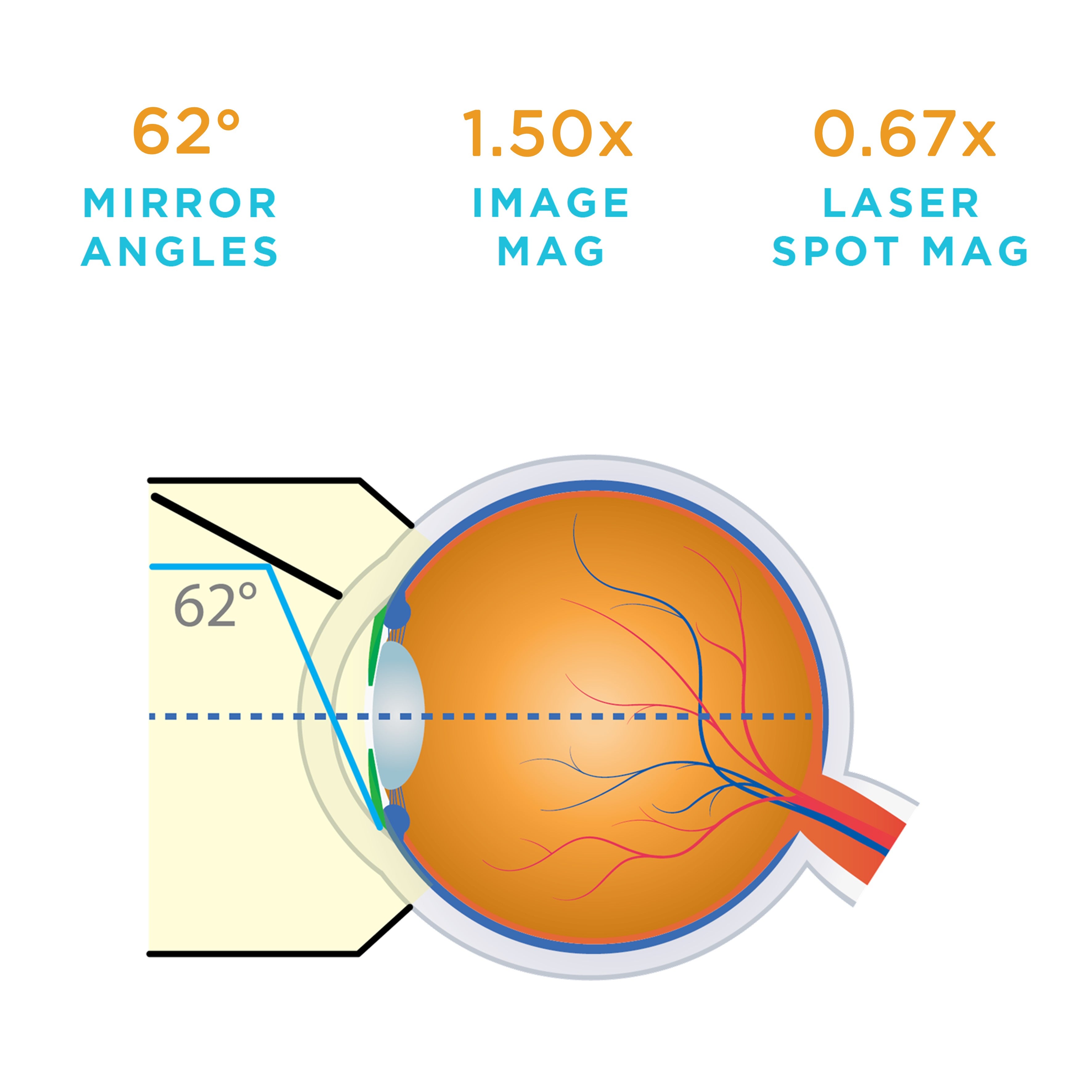 Buy Volk G-1 Gonio Lens - Volk Optical