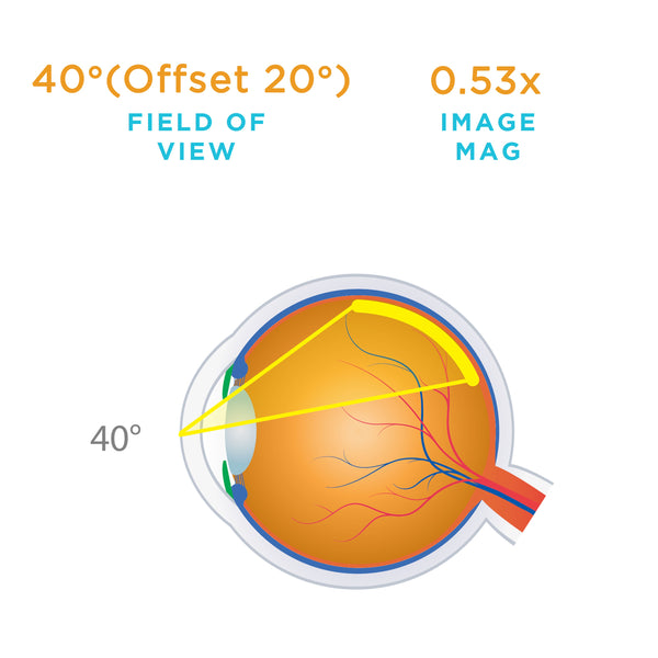 40° (Offset 20°) field of view