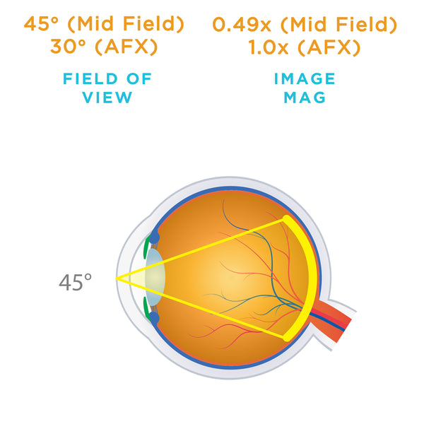 45° (Mid Field) / 30° (AFX) field of view