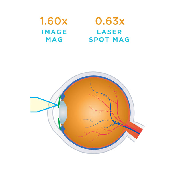 0.63x laser spot magnification