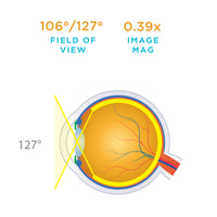 106° / 127° field of view