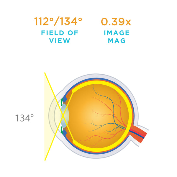 112° / 134° field of view