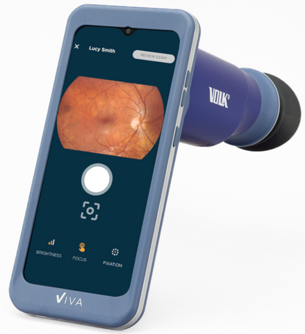 Viva Non-Mydriatic Handheld Retinal Camera