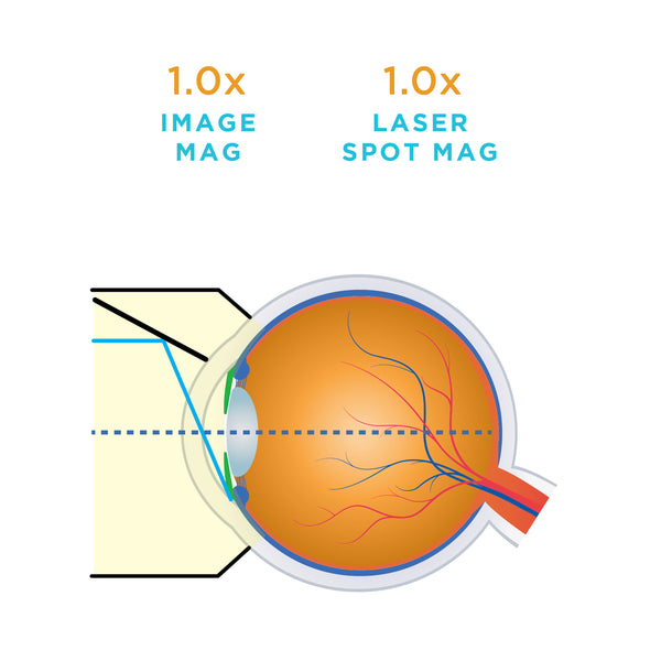 1.0x laser spot magnification