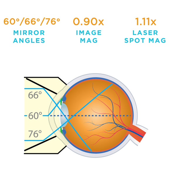 60° mirror provides a view of the iridocorneal angle