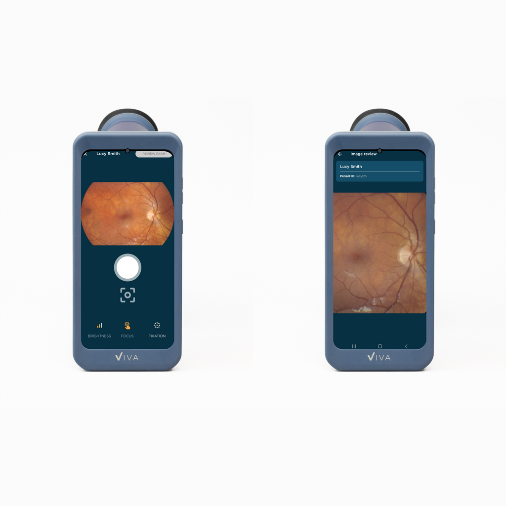 Retinal Camera Am Viva Non-Mydriatic Handheld Retinal Camera – Volk Optical