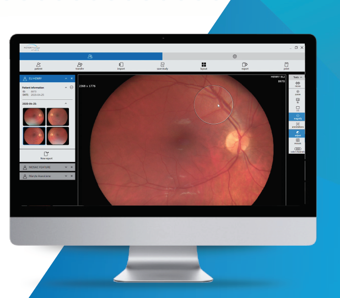 Pictor Prestige™ Portable Fundus Camera with Optional Anterior Module Vision 5